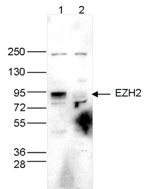 Western blot