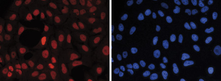 Immunofluorescence figure A