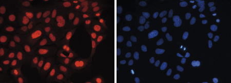 Immunofluorescence figure E